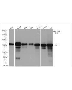 YAP1 Recombinant monoclonal antibody proteintech 81090-1-RR