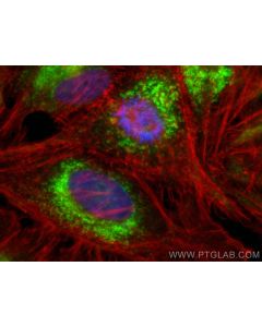 Anti-Human CD107b / LAMP2 (H4B4) Mouse IgG2a Recombinant Antibody proteintech 65566-1-MR