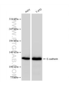 E-cadherin Recombinant monoclonal antibody proteintech 83991-4-RR