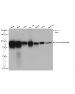 Glucocorticoid receptor Recombinant monoclonal antibody proteintech 82619-4-RR