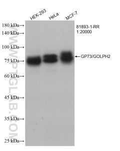GP73/GOLPH2 Recombinant monoclonal antibody proteintech 81893-1-RR