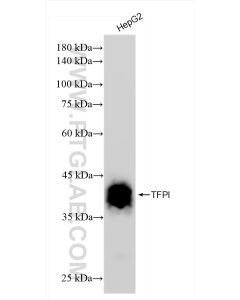 TFPI Recombinant monoclonal antibody proteintech 83838-5-RR