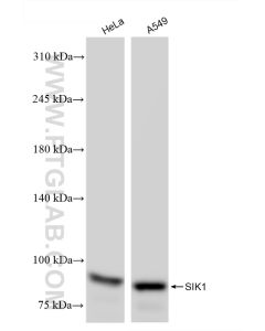 SIK1 Recombinant monoclonal antibody proteintech 83897-4-RR