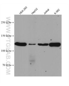 JAK3 Recombinant monoclonal antibody proteintech 80331-1-RR