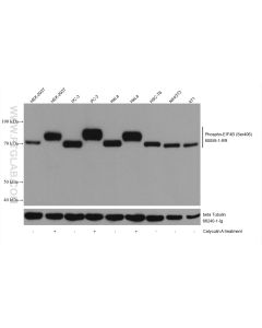 Phospho-EIF4B (Ser406) Recombinant monoclonal antibody proteintech 80059-1-RR