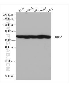 RORA Recombinant monoclonal antibody proteintech 82930-1-RR