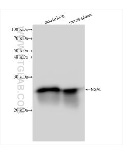 Lipocalin-2/NGAL Recombinant monoclonal antibody proteintech 83102-1-RR