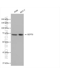 Septin 9 Recombinant monoclonal antibody proteintech 82844-2-RR