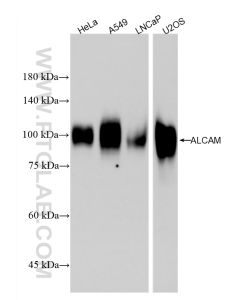 ALCAM Recombinant monoclonal antibody proteintech 86811-1-RR