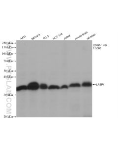 LASP1 Recombinant monoclonal antibody proteintech 82491-1-RR