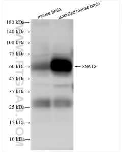 SNAT2 Recombinant monoclonal antibody proteintech 83968-5-RR