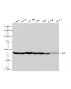LBR Recombinant monoclonal antibody proteintech 84522-6-RR