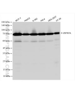 ZBTB7A Recombinant monoclonal antibody proteintech 83616-5-RR