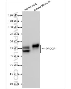 EPCR/CD201 Recombinant monoclonal antibody proteintech 84494-2-RR