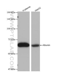 Albumin Recombinant monoclonal antibody proteintech 82783-6-RR