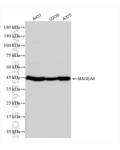MAGEA4 Recombinant monoclonal antibody proteintech 84248-6-RR