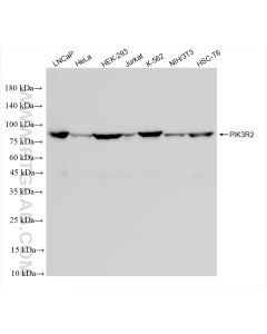 PI3 Kinase p85 Beta Recombinant monoclonal antibody proteintech 83606-5-RR