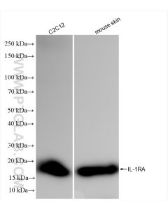 IL-1RA/IL-1RN Recombinant monoclonal antibody proteintech 85672-3-RR