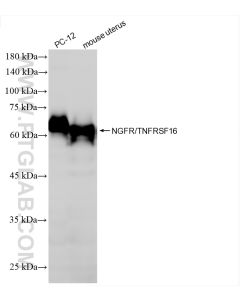 NGFR/TNFRSF16 Recombinant monoclonal antibody proteintech 85622-2-RR