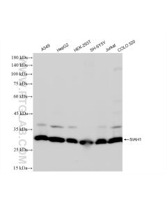 SIAH1 Recombinant monoclonal antibody proteintech 83389-4-RR