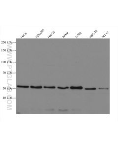 PEX14 Recombinant monoclonal antibody proteintech 80234-1-RR