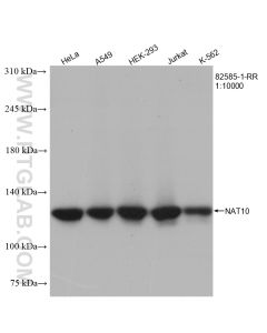 NAT10 Recombinant monoclonal antibody proteintech 82585-1-RR