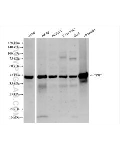 TIGIT Recombinant monoclonal antibody proteintech 83545-1-RR
