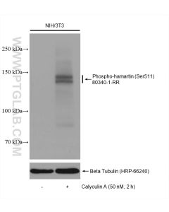 Phospho-Hamartin/TSC1 (Ser511) Recombinant monoclonal antibody proteintech 80340-1-RR