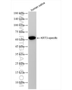 Cytokeratin 3 Recombinant monoclonal antibody proteintech 84042-1-RR