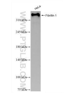 Fibrillin 1  Recombinant monoclonal antibody proteintech 83836-4-RR