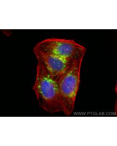 Anti-Human CD107a / LAMP1 Rabbit Recombinant Antibody proteintech 98266-2-RR