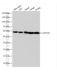 ZFP161 / ZBTB14 Recombinant monoclonal antibody proteintech 83909-4-RR