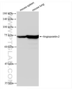 Angiopoietin-2 Recombinant monoclonal antibody proteintech 83816-1-RR