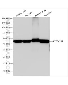 ATP6V1B1 Recombinant monoclonal antibody proteintech 83953-5-RR
