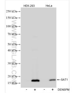 SAT1 Recombinant monoclonal antibody proteintech 83319-1-RR