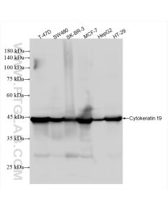 Cytokeratin 19 Recombinant monoclonal antibody proteintech 86250-1-RR