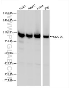 CKAP2L Recombinant monoclonal antibody proteintech 86247-1-RR