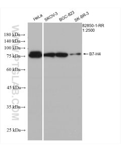 B7-H4 Recombinant monoclonal antibody proteintech 82850-1-RR