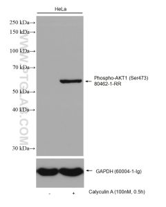 Phospho-AKT1 (Ser473) Recombinant monoclonal antibody proteintech 80462-1-RR