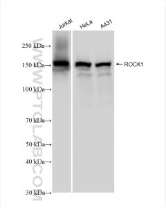 ROCK1 Recombinant monoclonal antibody proteintech 83166-5-RR