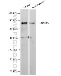 SCN11A Recombinant monoclonal antibody proteintech 85740-1-RR