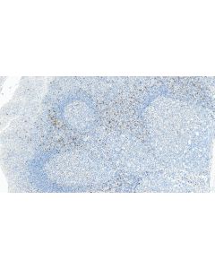 Anti-Human LAG-3/CD223 Rabbit Recombinant Antibody proteintech 98435-3-RR