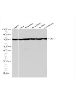 URAT1 Recombinant monoclonal antibody proteintech 82964-1-RR