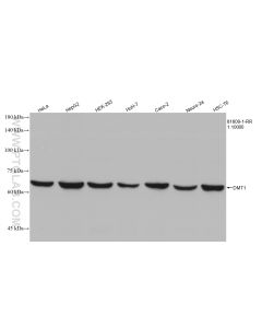 DMT1 Recombinant monoclonal antibody proteintech 81609-1-RR