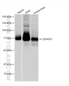 ZDHHC5 Recombinant monoclonal antibody proteintech 84803-4-RR