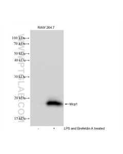 MCP-1/CCL2 Recombinant monoclonal antibody proteintech 83157-5-RR