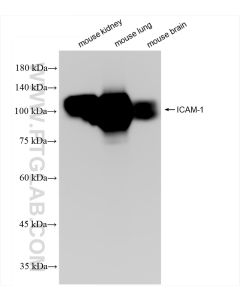 ICAM-1/CD54 Recombinant monoclonal antibody proteintech 82827-8-RR
