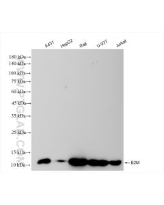 Beta-2-Microglobulin Recombinant monoclonal antibody proteintech 83683-6-RR