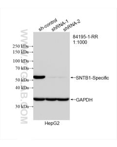 SNTB1-Specific Recombinant monoclonal antibody proteintech 84195-1-RR