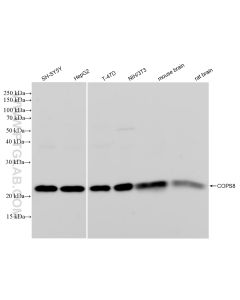 COPS8 Recombinant monoclonal antibody proteintech 83312-1-RR